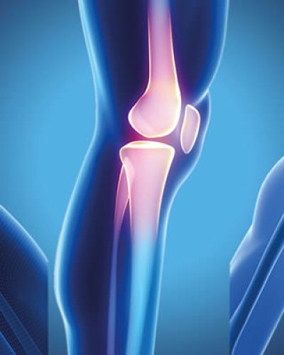 soluciones medicas de insumos para traumatologia y ortopedia en queretaro