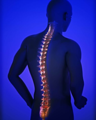 soluciones medicas en insumos para ioperaciones de columna en queretaro