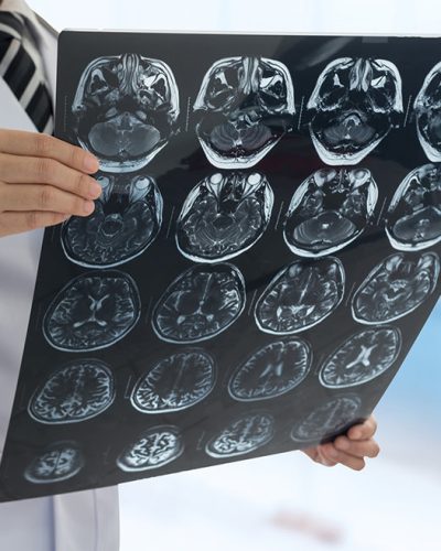 soluciones medicas en insumos para neurocirujia en queretaro