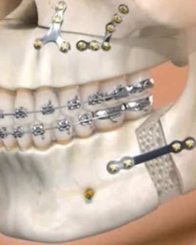 soluciones medicas en maxilofacial queretaro